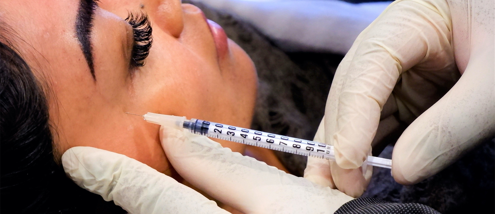Advanced Training in Botulinum Toxin