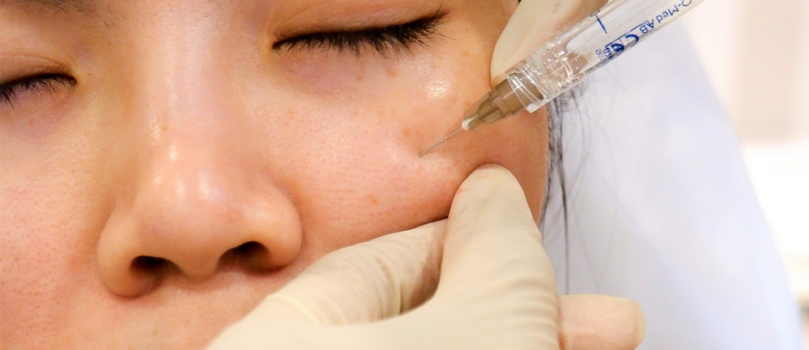 Advanced Training in Dermal Filler